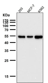 Anti-PTBP2 Rabbit Monoclonal Antibody Boster Bio