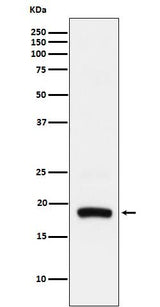 Anti-ARF5 Rabbit Monoclonal Antibody Boster Bio