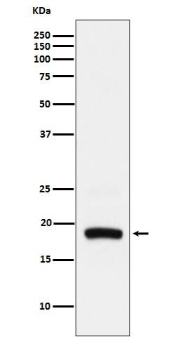 Anti-ARF5 Rabbit Monoclonal Antibody Boster Bio