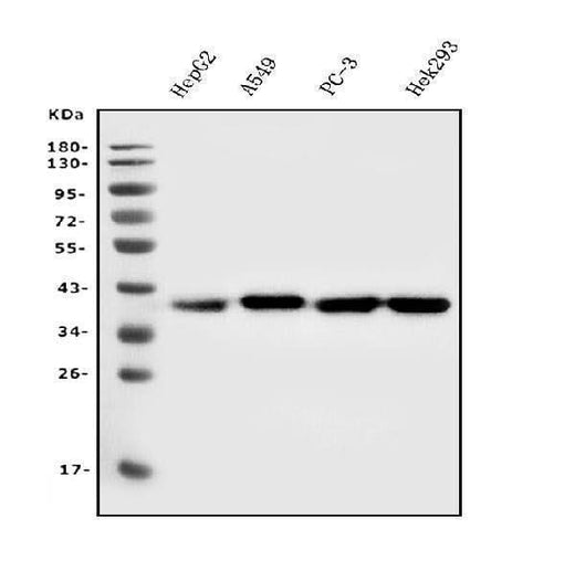 Anti-Aldolase/ALDOA Antibody Picoband® (monoclonal, 6H8 Boster Bio