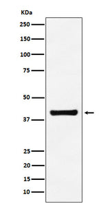 Anti-Aldolase ALDOA Monoclonal Antibody Boster Bio
