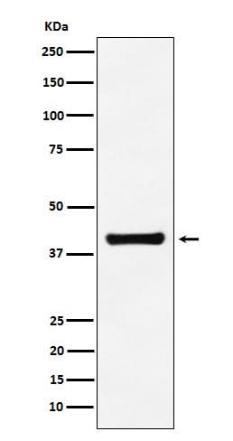 Anti-Aldolase ALDOA Monoclonal Antibody Boster Bio