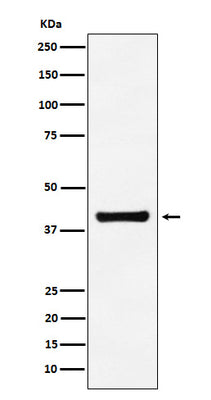 Anti-Aldolase ALDOA Monoclonal Antibody Boster Bio