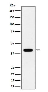 Anti-ACADS / SCAD Rabbit Monoclonal Antibody Boster Bio