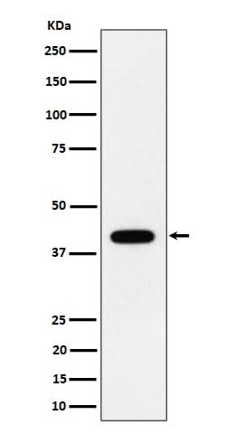 Anti-ACADS / SCAD Rabbit Monoclonal Antibody Boster Bio