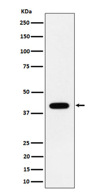 Anti-ACADS / SCAD Rabbit Monoclonal Antibody Boster Bio