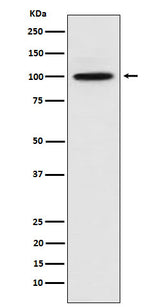Anti-CTNNA3 Rabbit Monoclonal Antibody Boster Bio