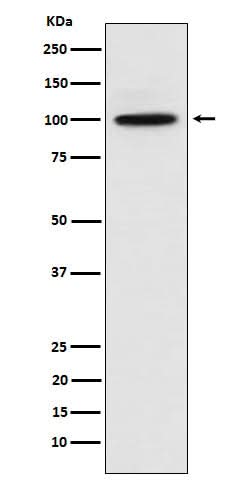 Anti-CTNNA3 Rabbit Monoclonal Antibody Boster Bio