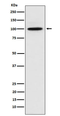 Anti-CTNNA3 Rabbit Monoclonal Antibody Boster Bio