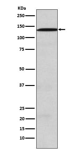Anti-USP28 Rabbit Monoclonal Antibody Boster Bio