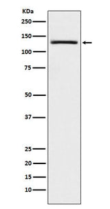 Anti-USP28 Monoclonal Antibody Boster Bio