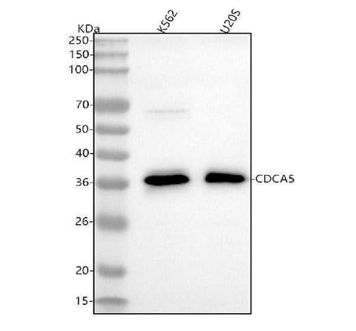 Anti-CDCA5/Sororin Rabbit Monoclonal Antibody Boster Bio