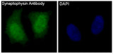 Anti-Synaptophysin SYP Rabbit Monoclonal Antibody Boster Bio