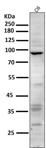 Anti-CD168 HMMR Rabbit Monoclonal Antibody Boster Bio