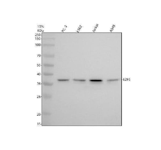 Anti-E2F6 Rabbit Monoclonal Antibody Boster Bio