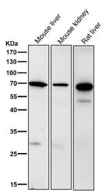 Anti-Ribophorin I Rabbit Monoclonal Antibody Boster Bio
