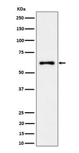 Anti-EYA2 Rabbit Monoclonal Antibody Boster Bio