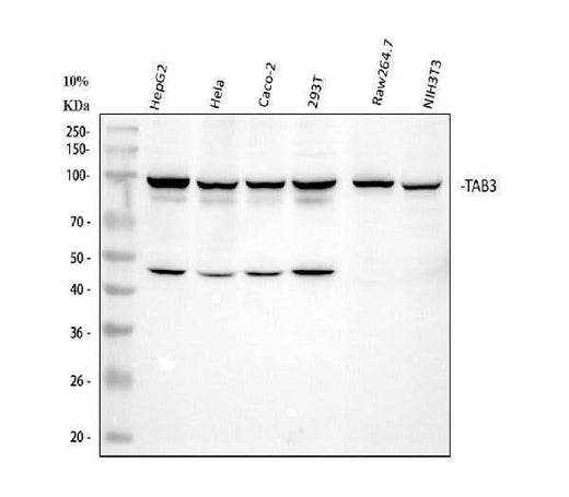 Anti-TAB3 Rabbit Monoclonal Antibody Boster Bio
