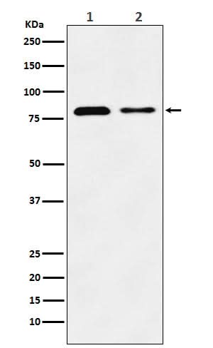 Anti-LIMPII Rabbit Monoclonal Antibody Boster Bio