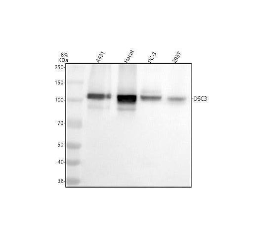 Anti-Desmocollin-3 Rabbit Monoclonal Antibody Boster Bio