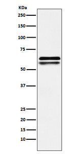 Anti-NAP1L1 Rabbit Monoclonal Antibody Boster Bio