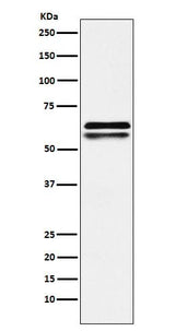Anti-NAP1L1 Rabbit Monoclonal Antibody Boster Bio