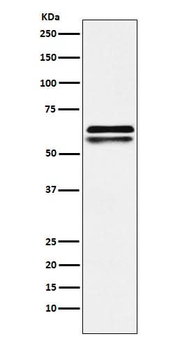 Anti-NAP1L1 Rabbit Monoclonal Antibody Boster Bio
