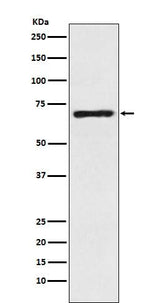 Anti-SLC6A1 / GAT1 Rabbit Monoclonal Antibody Boster Bio