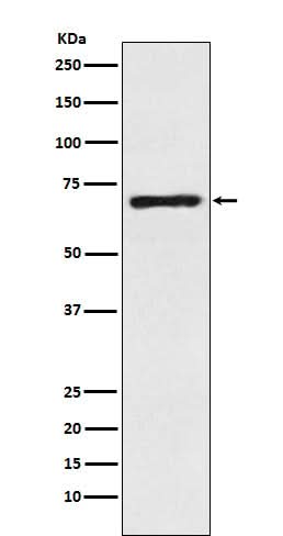 Anti-SLC6A1 / GAT1 Rabbit Monoclonal Antibody Boster Bio