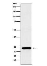 Anti-Rab25 Rabbit Monoclonal Antibody Boster Bio