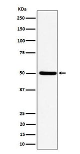 Anti-UBA3 Rabbit Monoclonal Antibody Boster Bio