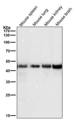 Anti-FDFT1 Monoclonal Antibody Boster Bio