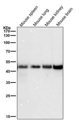 Anti-FDFT1 Monoclonal Antibody Boster Bio