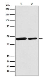 Anti-Citrate synthetase CS Monoclonal Antibody Boster Bio