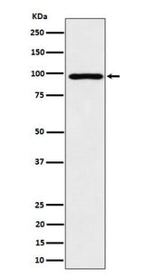 Anti-AKAP 95 Rabbit Monoclonal Antibody Boster Bio