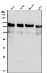 Anti-Phospho-UBF1 (S484) Rabbit Monoclonal Antibody Boster Bio