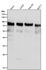 Anti-Phospho-UBF1 (S484) Rabbit Monoclonal Antibody Boster Bio