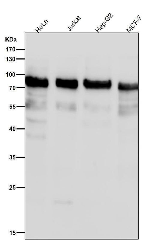 Anti-Phospho-UBF1 (S484) Rabbit Monoclonal Antibody Boster Bio