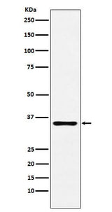 Anti-DCR2 Rabbit Monoclonal Antibody Boster Bio
