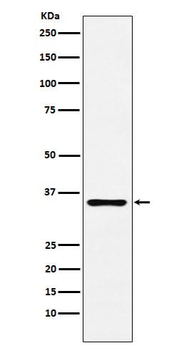 Anti-DCR2 Rabbit Monoclonal Antibody Boster Bio