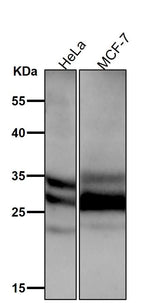 Anti-Caspase-14 Rabbit Monoclonal Antibody Boster Bio
