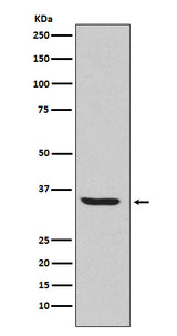 Anti-Endo G Rabbit Monoclonal Antibody Boster Bio