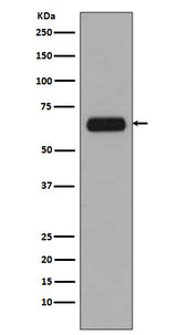Anti-TCF3 TCF7L1 Rabbit Monoclonal Antibody Boster Bio