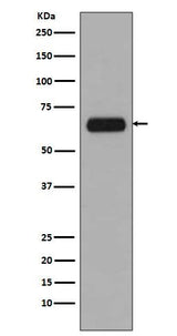 Anti-TCF3 TCF7L1 Rabbit Monoclonal Antibody Boster Bio