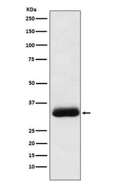 Anti-Alpha SNAP Rabbit Monoclonal Antibody Boster Bio
