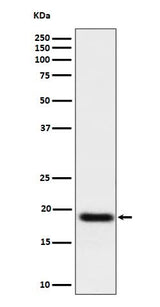 Anti-TNFAIP8 Rabbit Monoclonal Antibody Boster Bio