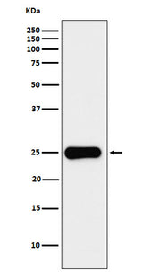 Anti-Placental lactogen Rabbit Monoclonal Antibody Boster Bio