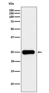 Anti-Placental lactogen Rabbit Monoclonal Antibody Boster Bio