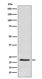 Anti-Placental lactogen CSH1 Monoclonal Antibody Boster Bio