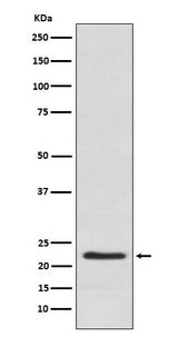 Anti-Placental lactogen CSH1 Monoclonal Antibody Boster Bio